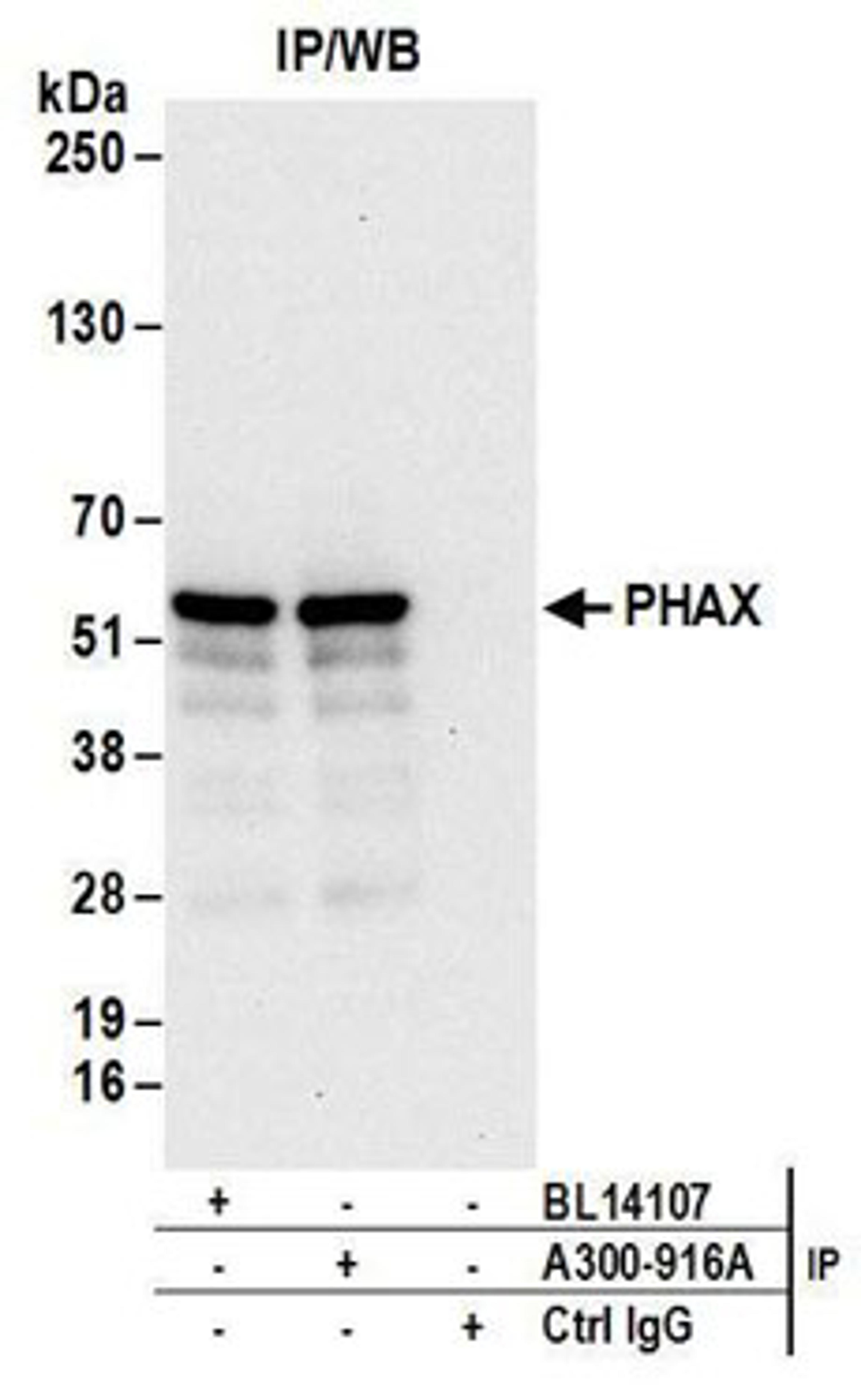 Detection of human PHAX by western blot of immunoprecipitates.