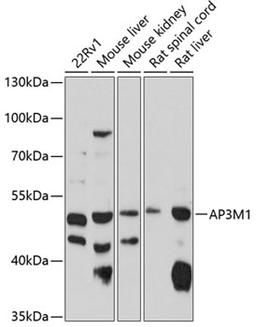 Western blot - AP3M1 antibody (A10410)