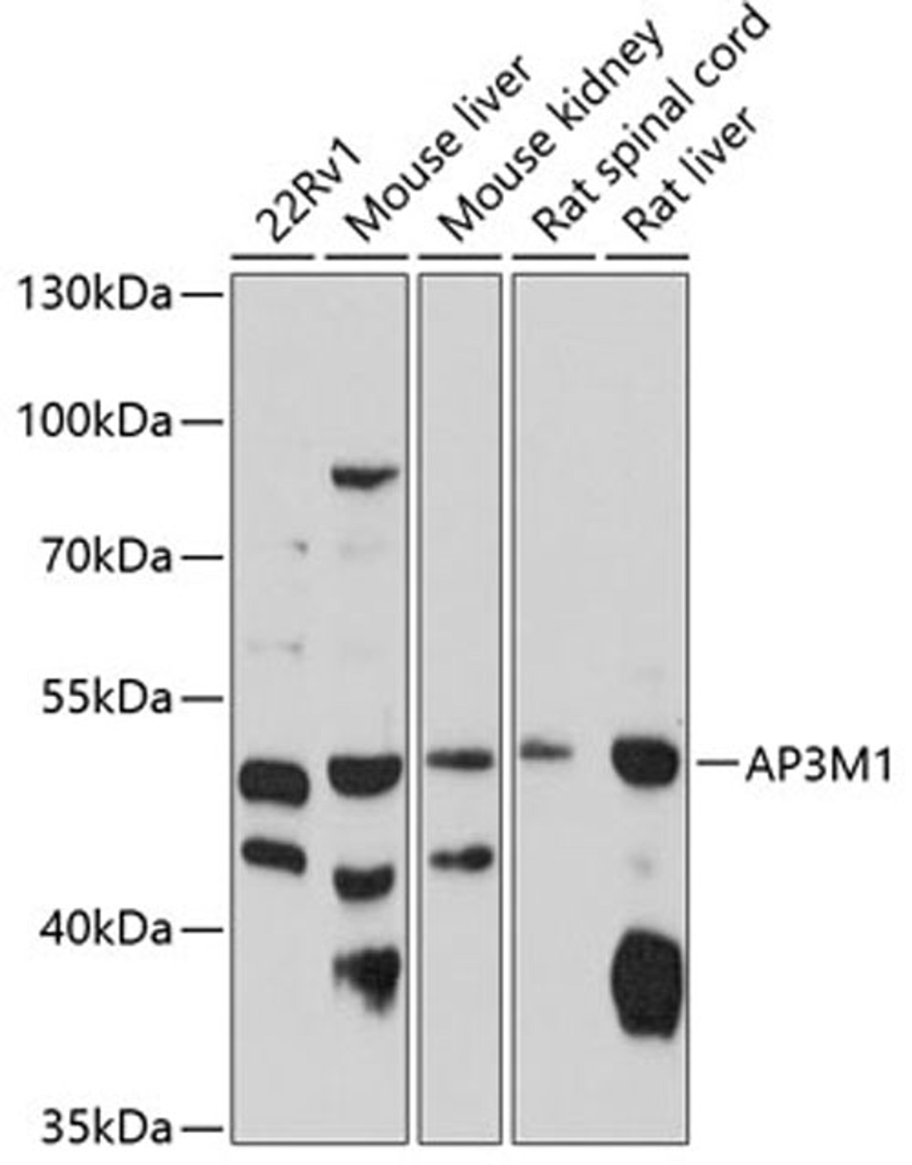 Western blot - AP3M1 antibody (A10410)