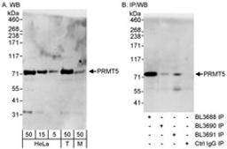 Detection of human and mouse PRMT5 by western blot (h&m) and immunoprecipitation (h).