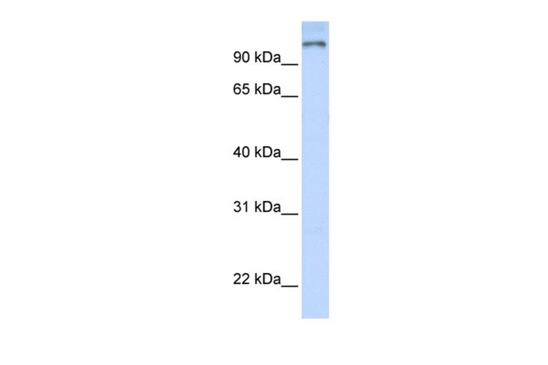 Antibody used in WB on Human Brain at 0.2-1 ug/ml.