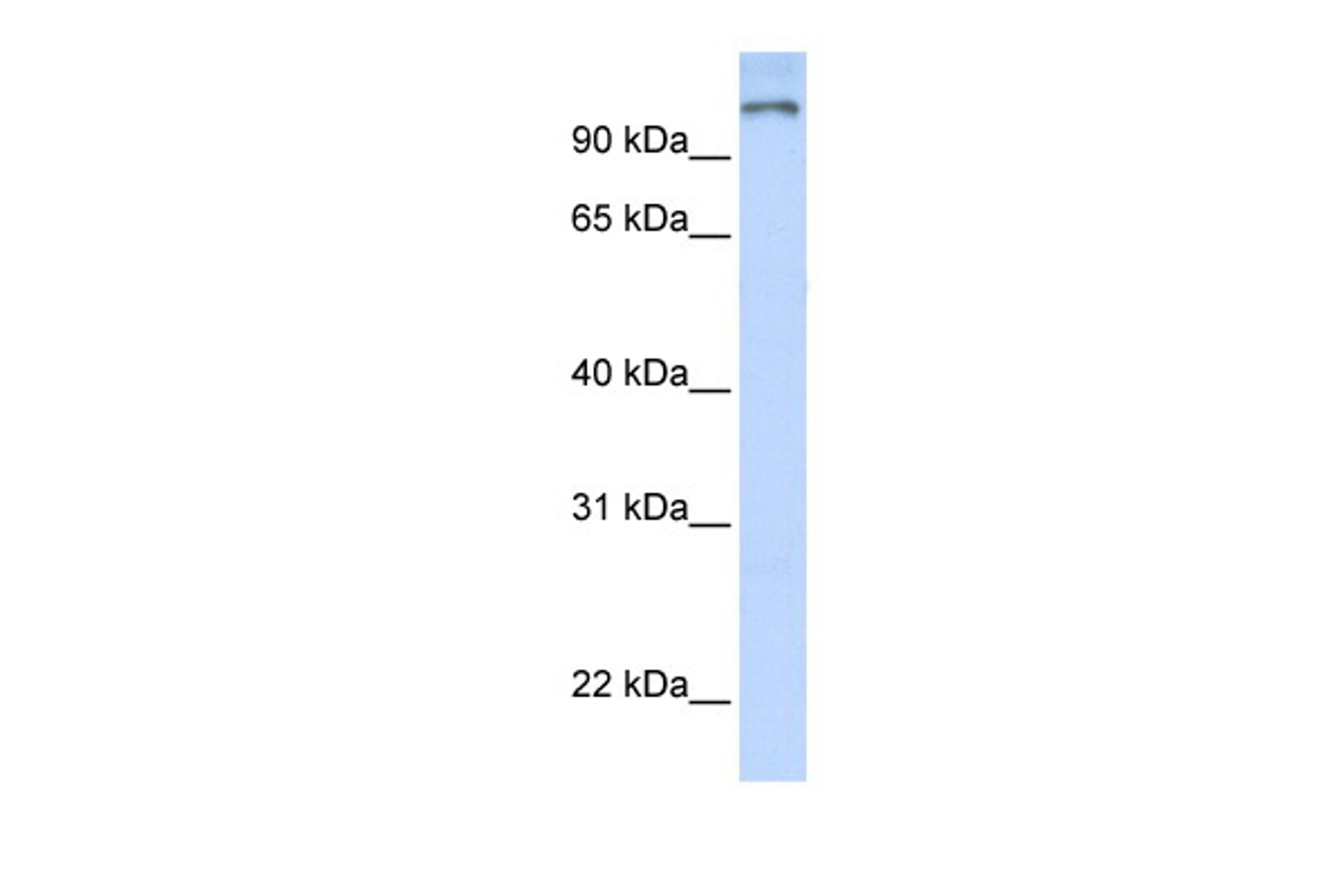 Antibody used in WB on Human Brain at 0.2-1 ug/ml.