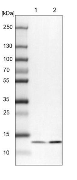 Western Blot: UQCRB Antibody [NBP1-80860] - Lane 1: NIH-3T3 cell lysate (Mouse embryonic fibroblast cells)<br/>Lane 2: NBT-II cell lysate (Rat Wistar bladder tumour cells)