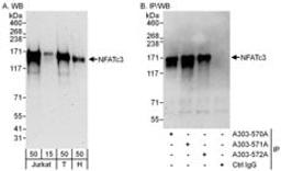 Detection of human NFATc3 by western blot and immunoprecipitation.