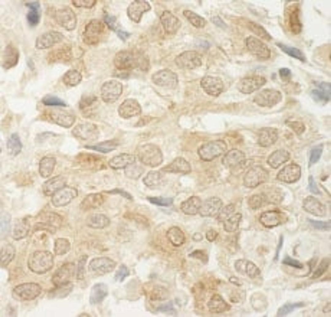 Detection of human MED15 by immunohistochemistry.