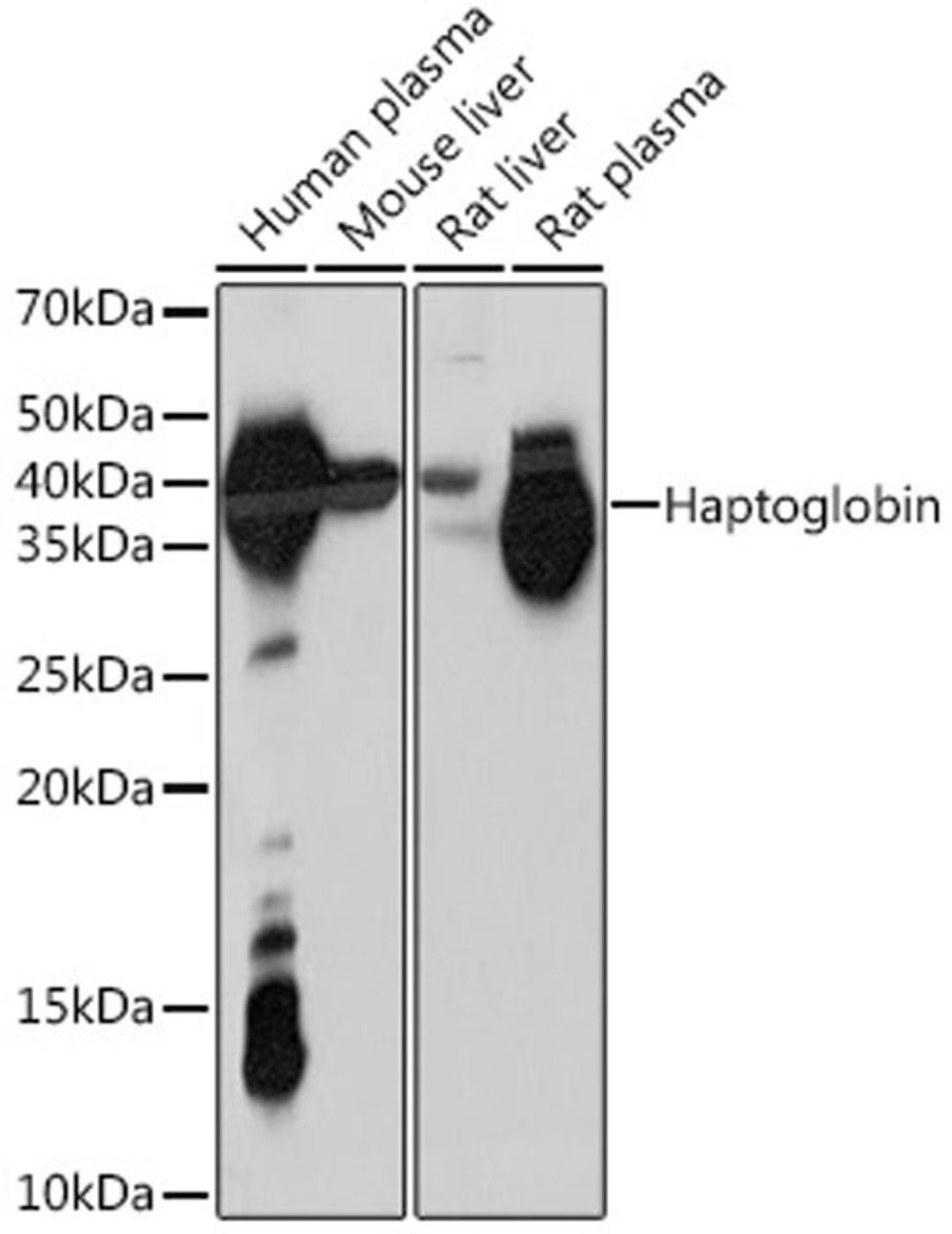 Western blot - Haptoglobin Rabbit mAb (A8778)