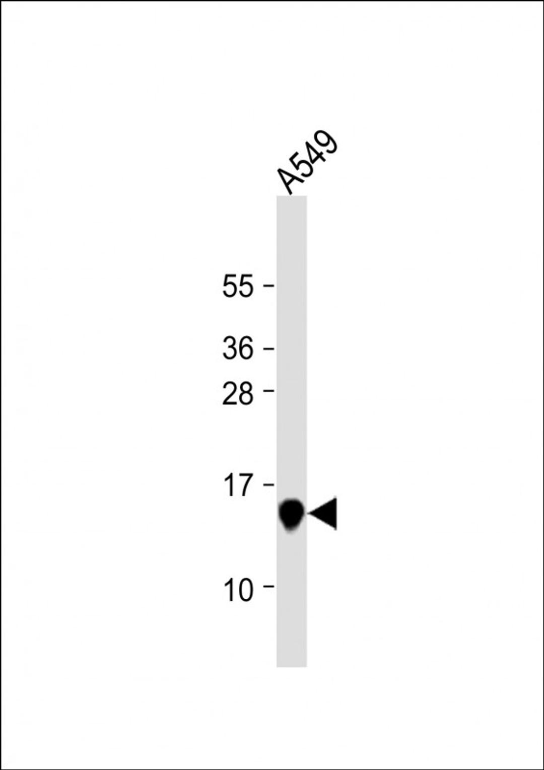 Western Blot at 1:1000 dilution + A549 whole cell lysate Lysates/proteins at 20 ug per lane.