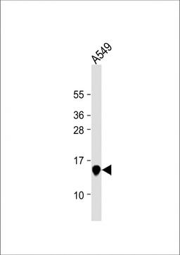 Western Blot at 1:1000 dilution + A549 whole cell lysate Lysates/proteins at 20 ug per lane.