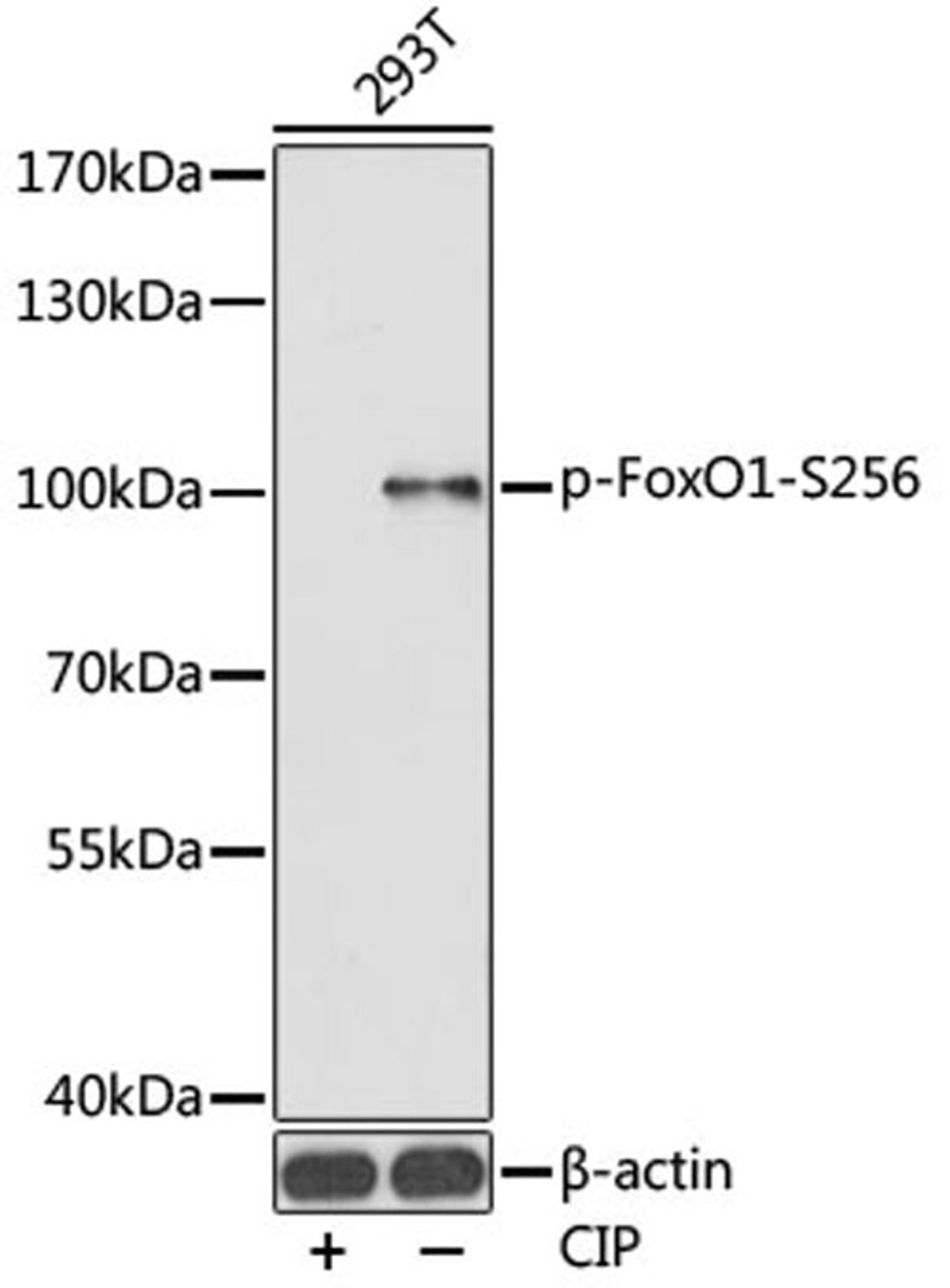 Western blot - Phospho-FoxO1-S256 antibody (AP0172)