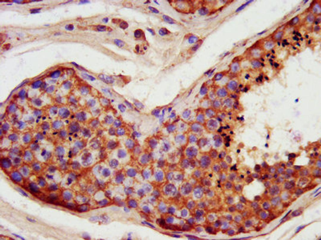 IHC image of CSB-PA839274LA01HU diluted at 1:400 and staining in paraffin-embedded human testis tissue performed on a Leica BondTM system. After dewaxing and hydration, antigen retrieval was mediated by high pressure in a citrate buffer (pH 6.0). Section was blocked with 10% normal goat serum 30min at RT. Then primary antibody (1% BSA) was incubated at 4°C overnight. The primary is detected by a biotinylated secondary antibody and visualized using an HRP conjugated SP system.