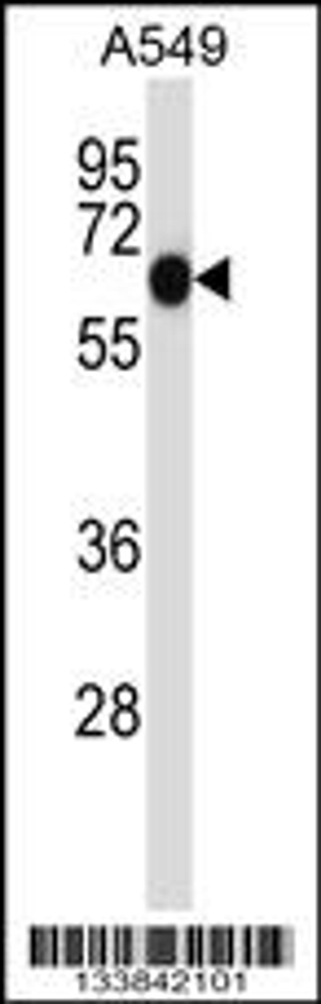 Western blot analysis in A549 cell line lysates (35ug/lane).