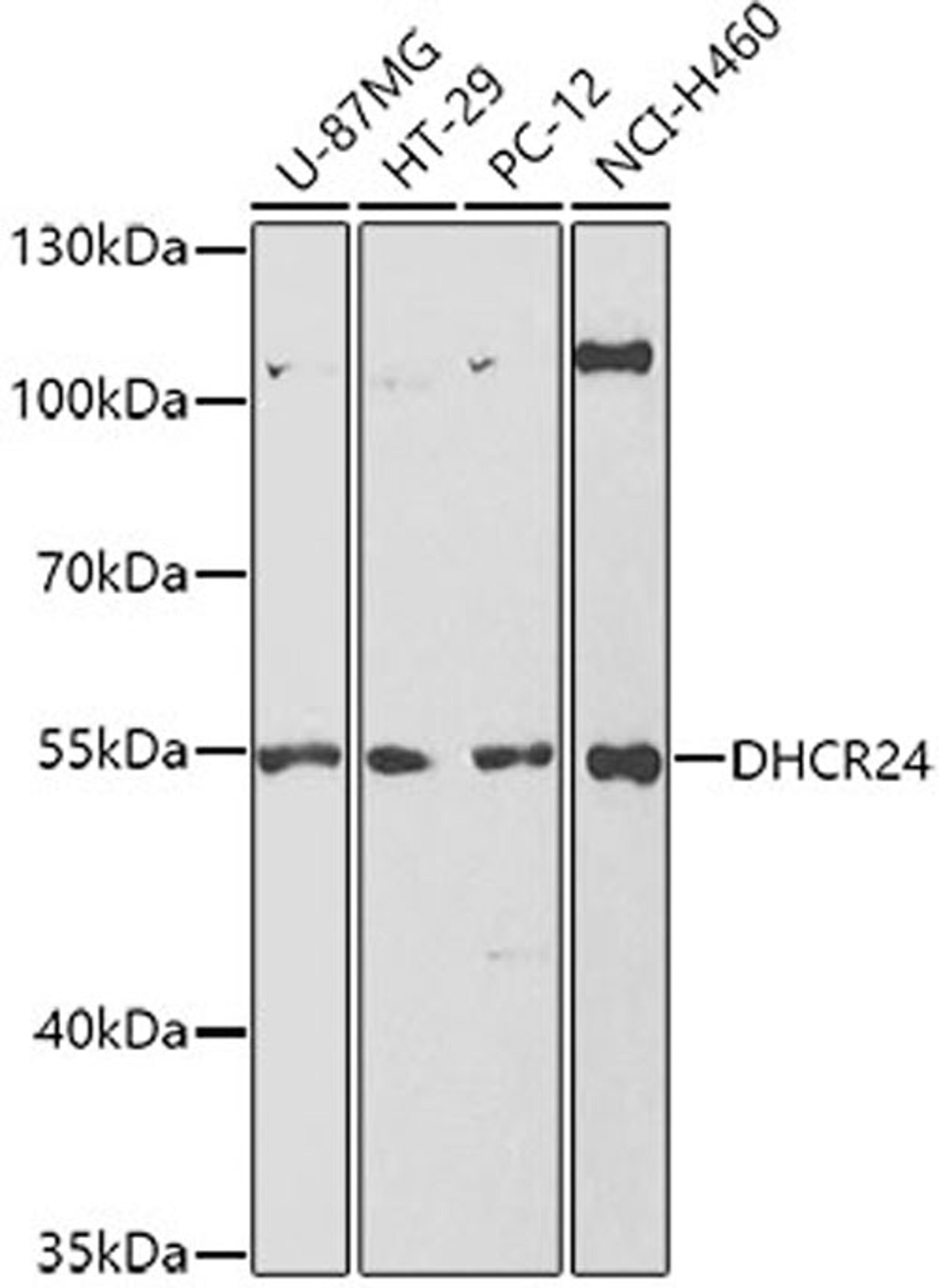 Western blot - DHCR24 antibody (A5402)