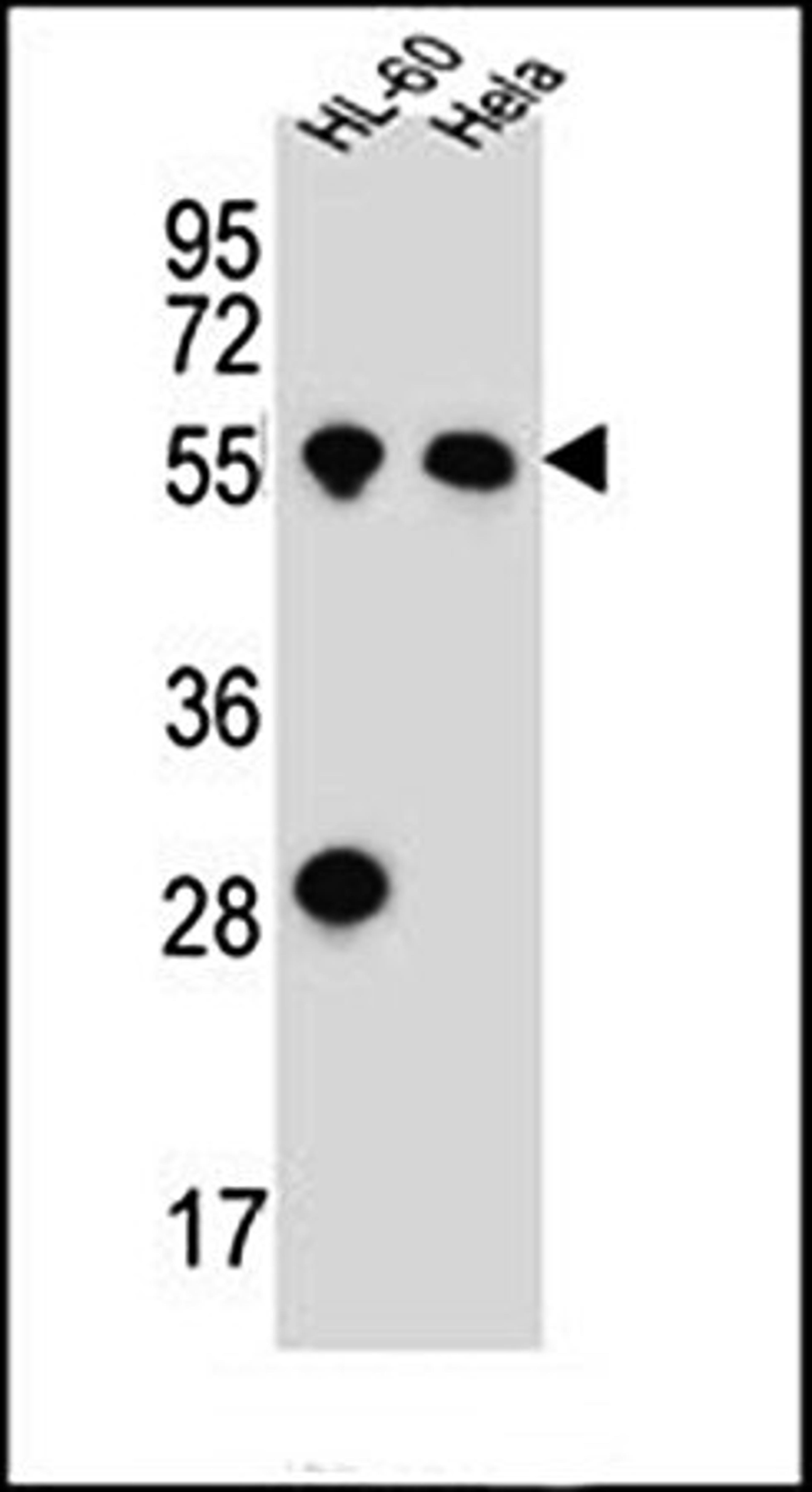 Western blot analysis of HL-60, HeLa cell line lysates with HAS2 antibody