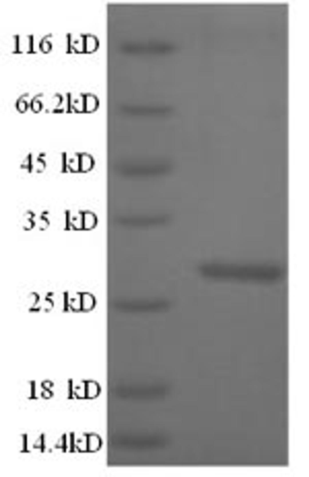 (Tris-Glycine gel) Discontinuous SDS-PAGE (reduced) with 5% enrichment gel and 15% separation gel.