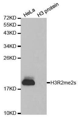 Western blot analysis of extracts of HeLa cell line and H3 protein expressed in E.coli using HIST3H3 antibody