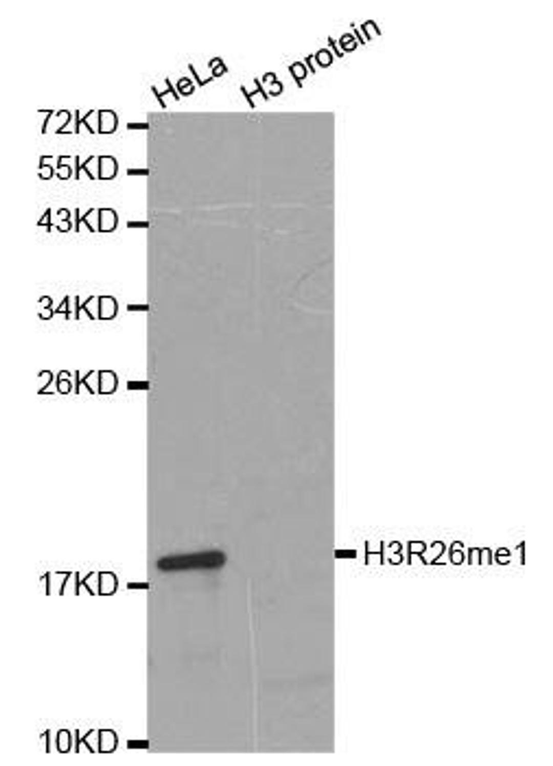 Western blot analysis of extracts of HeLa cell line and H3 protein expressed in E.coli using HIST3H3 antibody