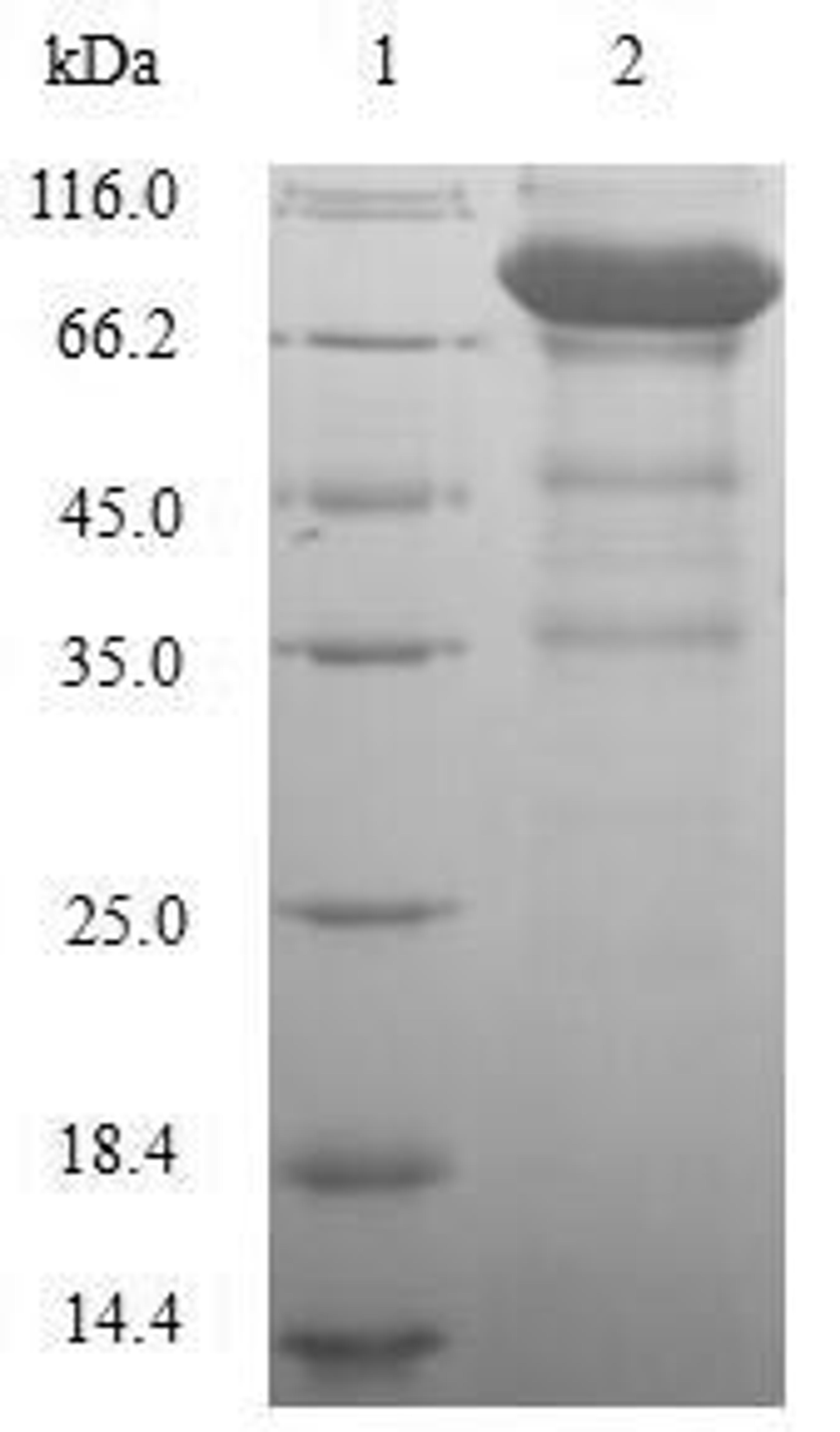 (Tris-Glycine gel) Discontinuous SDS-PAGE (reduced) with 5% enrichment gel and 15% separation gel.