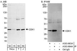 Detection of human CDK1 by western blot and immunoprecipitation.