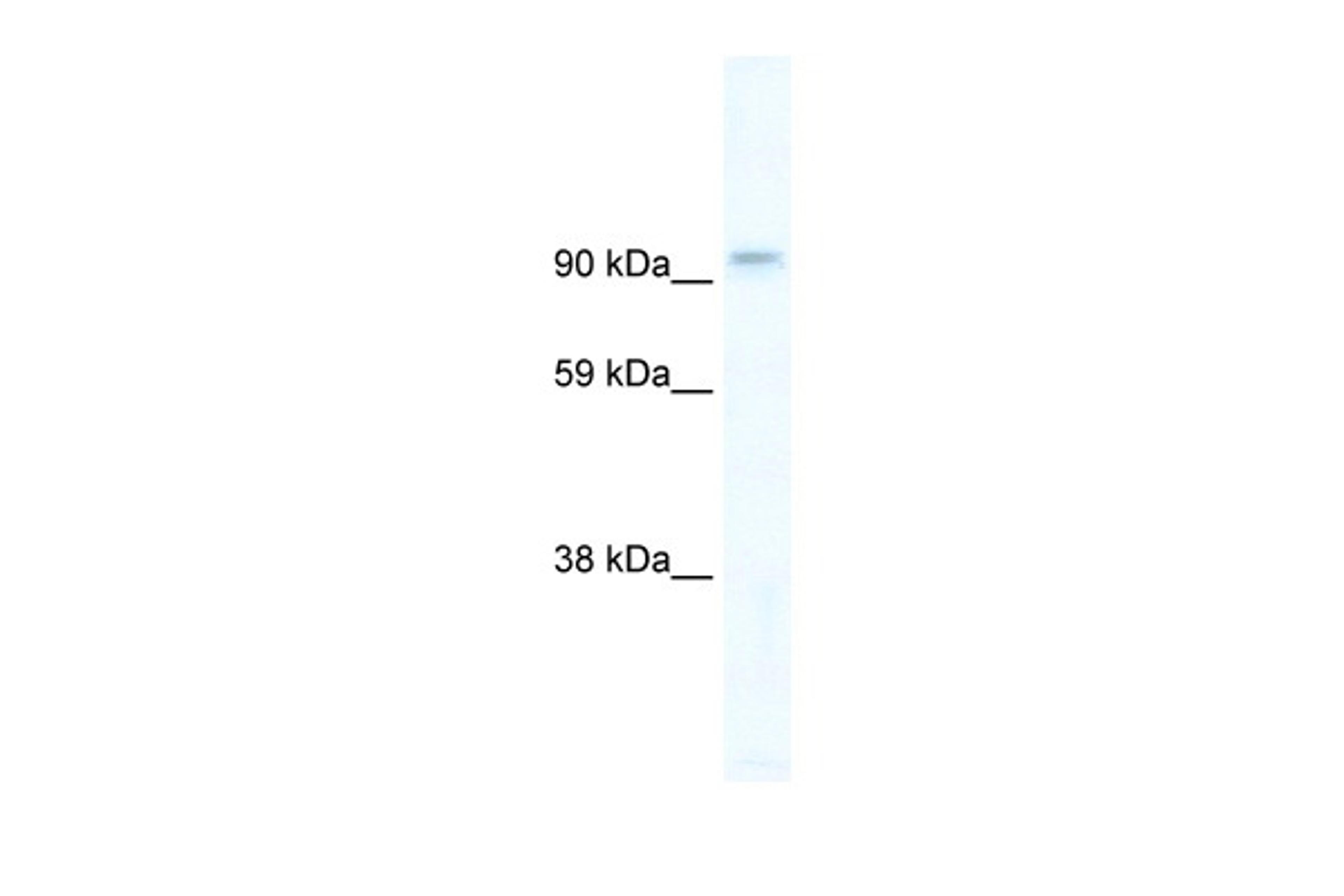 Antibody used in WB on Human Brain at 5 ug/ml.