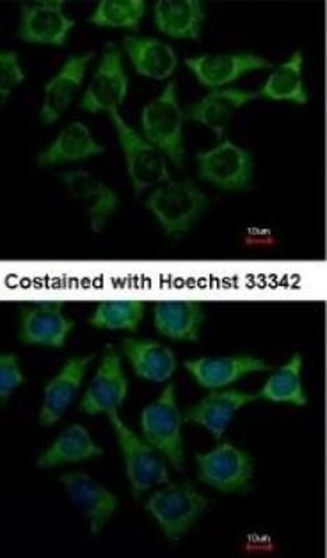 Immunocytochemistry: Loricrin Antibody [NBP1-33610] - Immunofluorescence:  [NBP1-33610] - Analysis of methanol-fixed Hep3B, using antibody at 1:500 dilution.