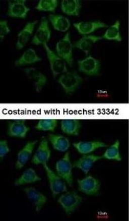 Immunocytochemistry: Loricrin Antibody [NBP1-33610] - Immunofluorescence:  [NBP1-33610] - Analysis of methanol-fixed Hep3B, using antibody at 1:500 dilution.