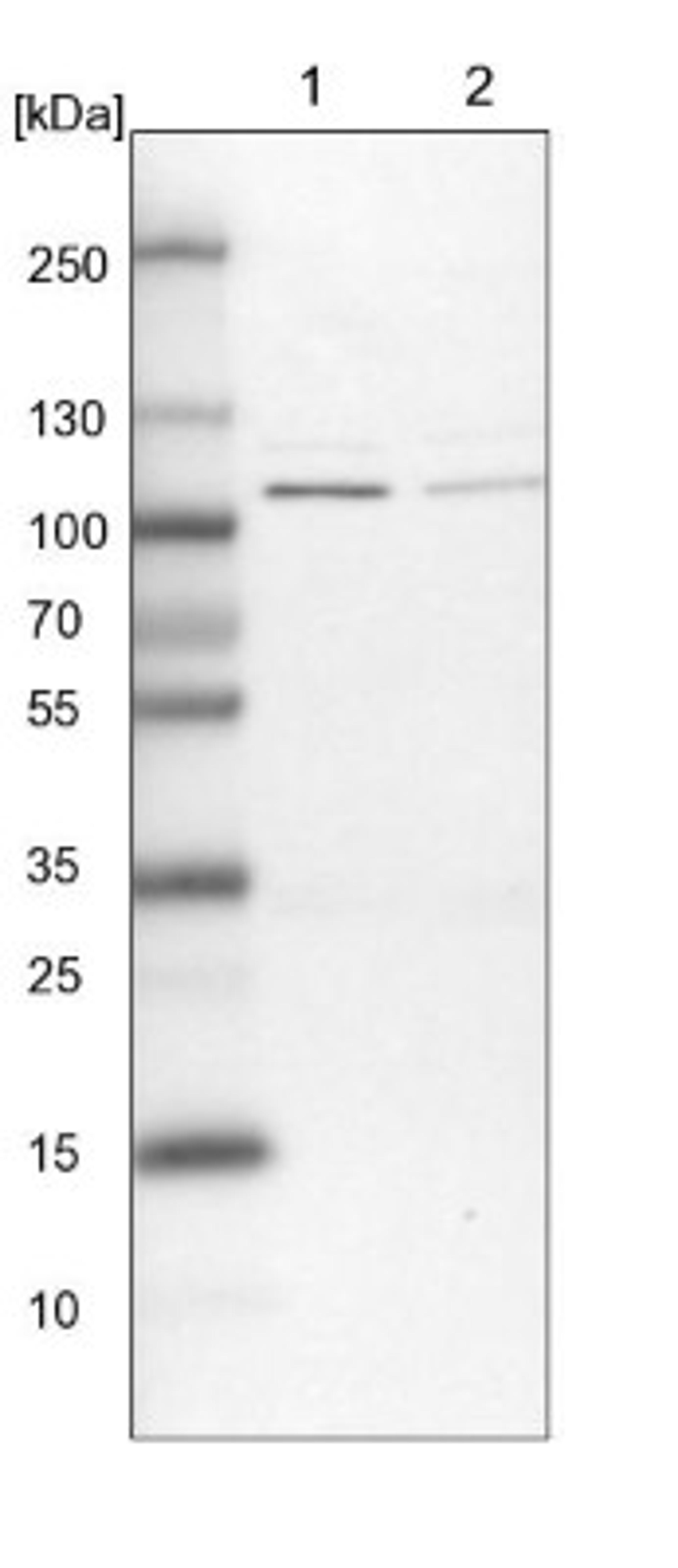 Western Blot: GAP1m Antibody [NBP1-89794] - Lane 1: NIH-3T3 cell lysate (Mouse embryonic fibroblast cells)<br/>Lane 2: NBT-II cell lysate (Rat Wistar bladder tumour cells)