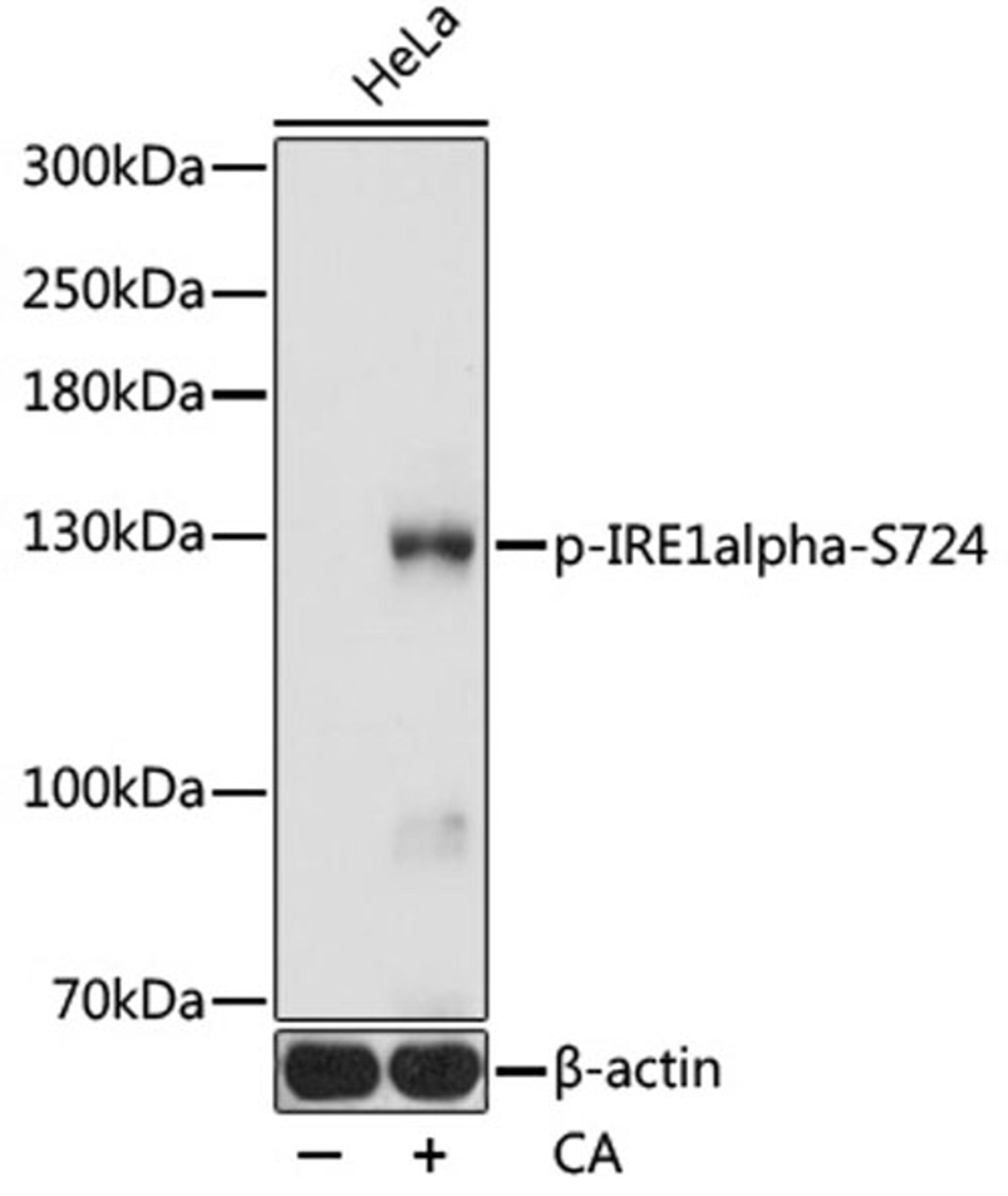 Western blot - Phospho-IRE1alpha-S724 antibody (AP0878)