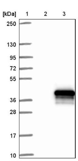 Western Blot: MMTAG2 Antibody [NBP1-92128] - Lane 1: Marker [kDa] 250, 130, 95, 72, 55, 36, 28, 17, 10<br/>Lane 2: Negative control (vector only transfected HEK293T lysate)<br/>Lane 3: Over-expression lysate (Co-expressed with a C-terminal myc-DDK tag (~3.1 kDa) in mammalian HEK293T cells, LY411316)