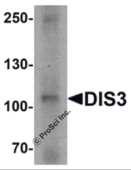 Western blot analysis of DIS3 in human ovary tissue lysate with DIS3 antibody at 1 &#956;g/mL.