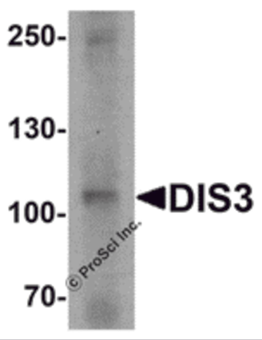 Western blot analysis of DIS3 in human ovary tissue lysate with DIS3 antibody at 1 μg/mL.