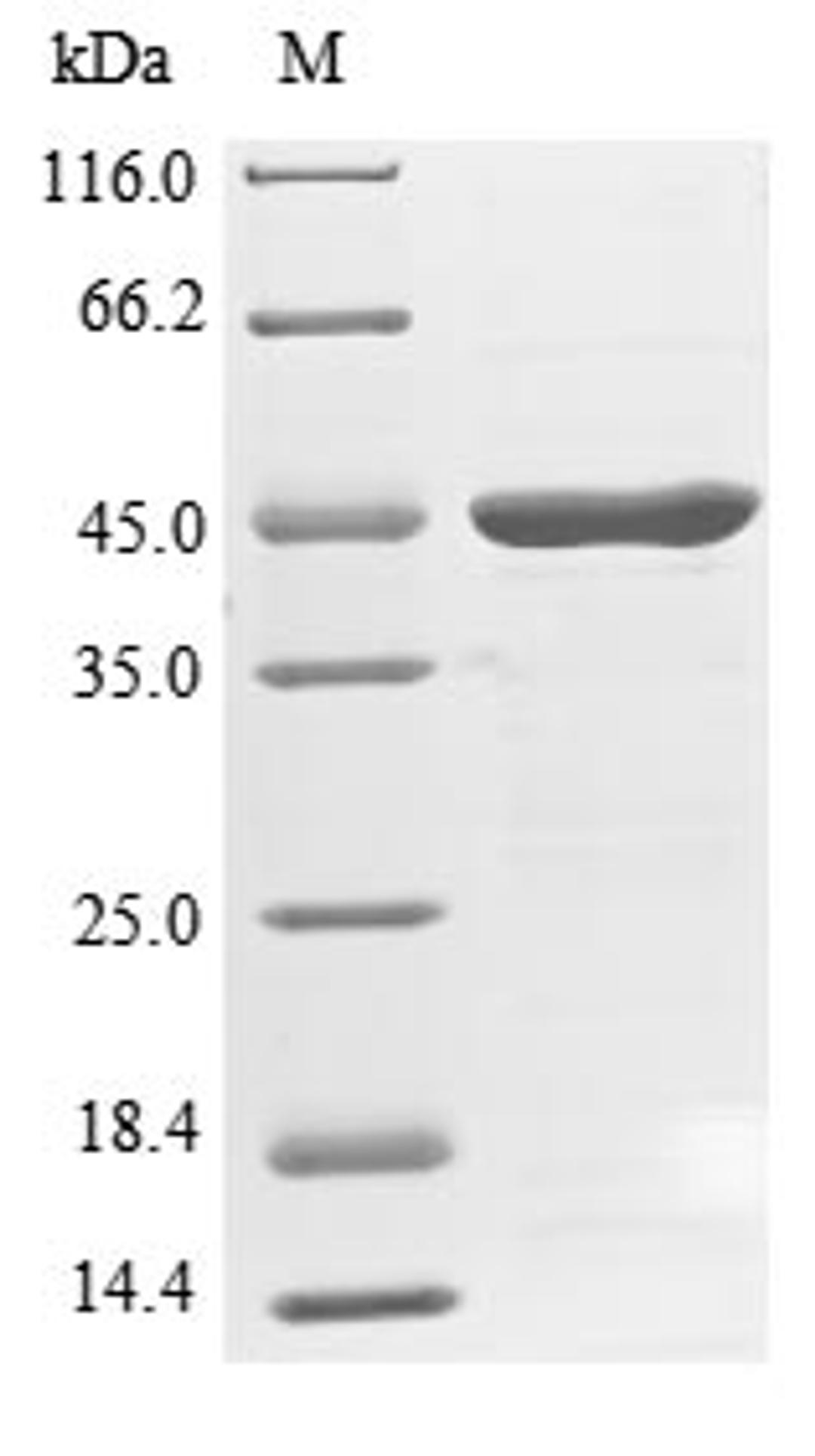 (Tris-Glycine gel) Discontinuous SDS-PAGE (reduced) with 5% enrichment gel and 15% separation gel.