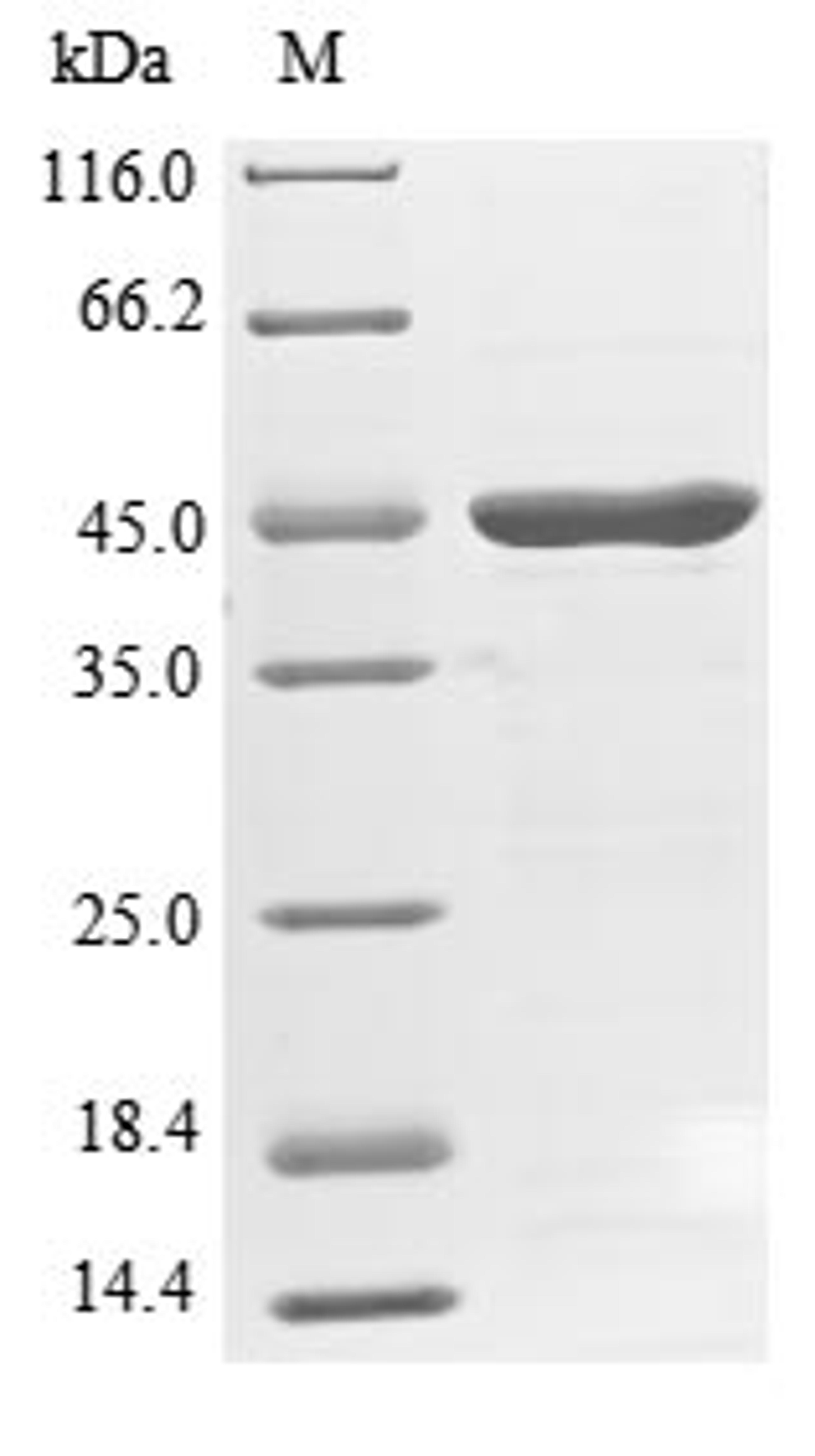 (Tris-Glycine gel) Discontinuous SDS-PAGE (reduced) with 5% enrichment gel and 15% separation gel.