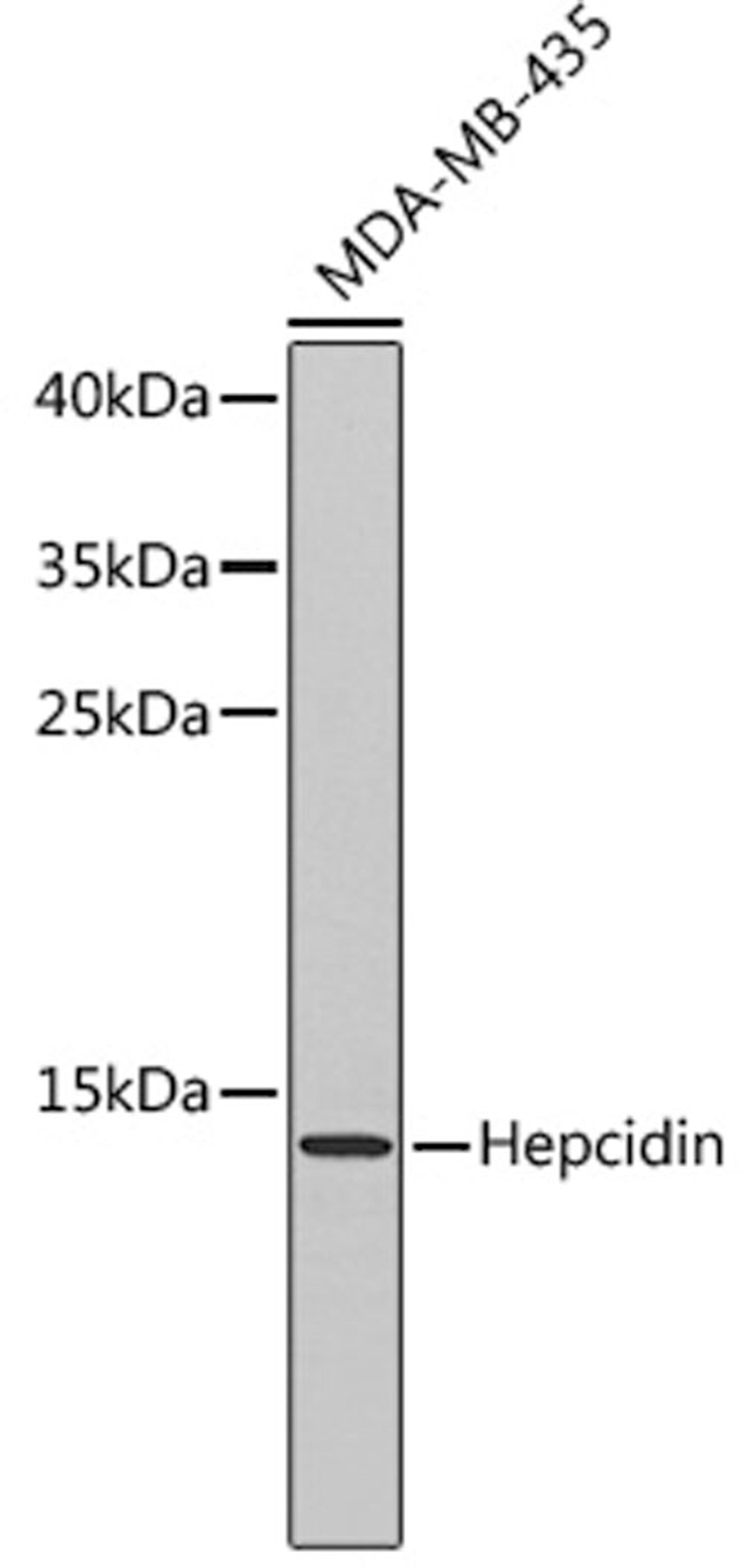 Western blot - Hepcidin antibody (A1601)