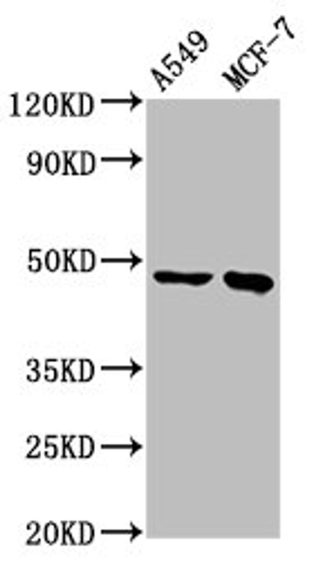 Western Blot. Positive WB detected in: A549 whole cell lysate, MCF-7 whole cell lysate. All lanes: ESRRB antibody at 3.7µg/ml. Secondary. Goat polyclonal to rabbit IgG at 1/50000 dilution. Predicted band size: 49, 57, 56 kDa. Observed band size: 49 kDa