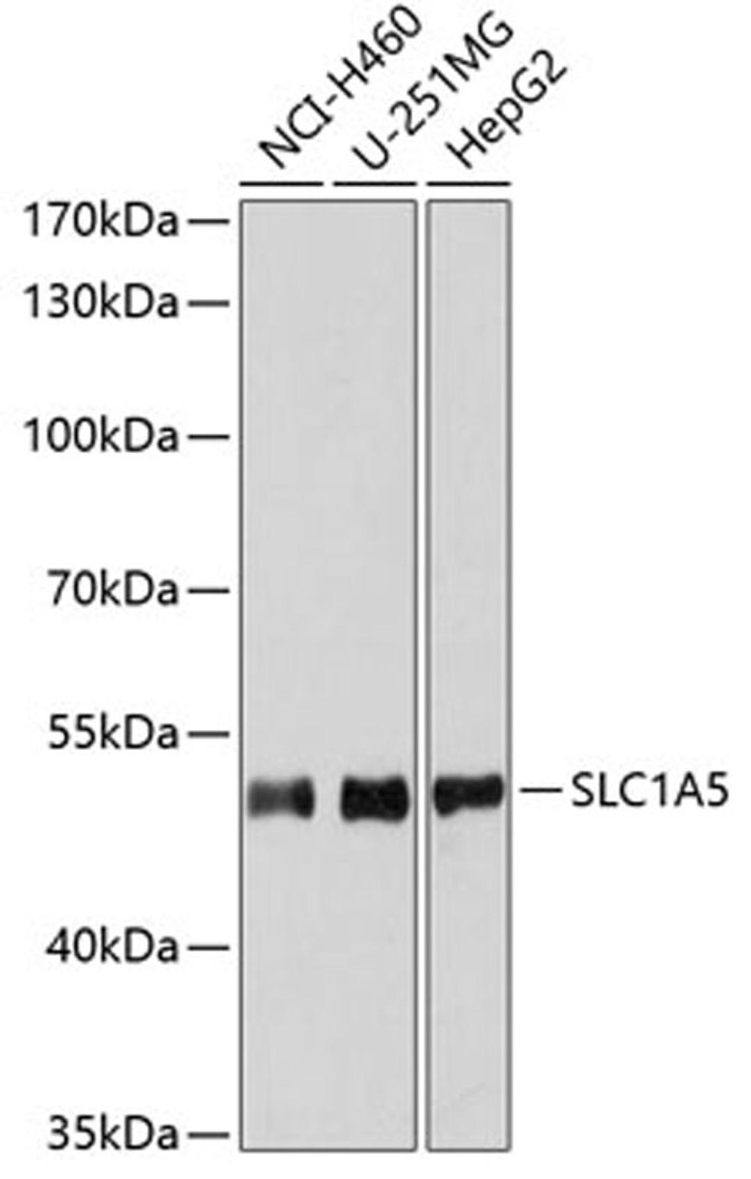 Western blot - SLC1A5 antibody (A6981)