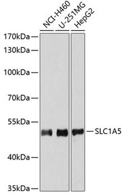 Western blot - SLC1A5 antibody (A6981)