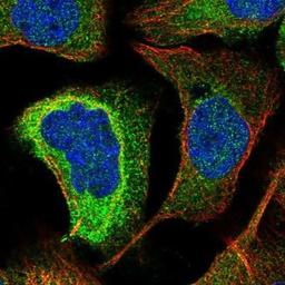 Immunocytochemistry/Immunofluorescence: KIAA0753 Antibody [NBP1-90931] - Staining of human cell line A-431 shows positivity in cytoplasm & centrosome.