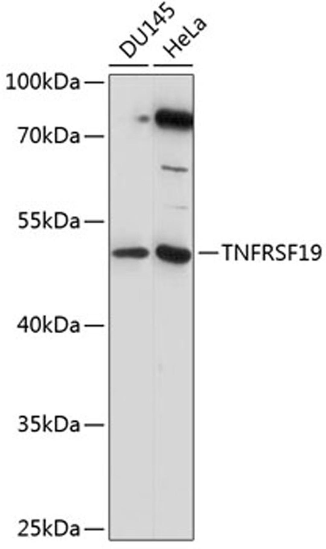 Western blot - TNFRSF19 antibody (A14284)