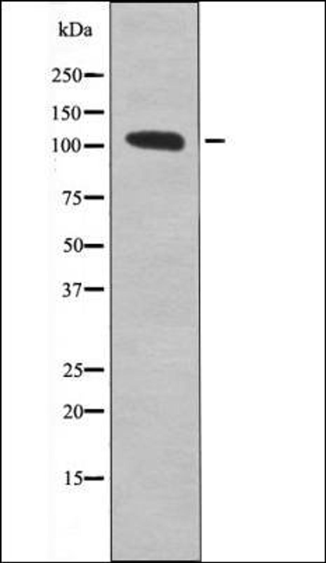 Western blot analysis of Insulin treated 293 whole cell lysates using Retinoblastoma -Phospho-Ser612- antibody