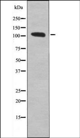 Western blot analysis of Insulin treated 293 whole cell lysates using Retinoblastoma -Phospho-Ser612- antibody