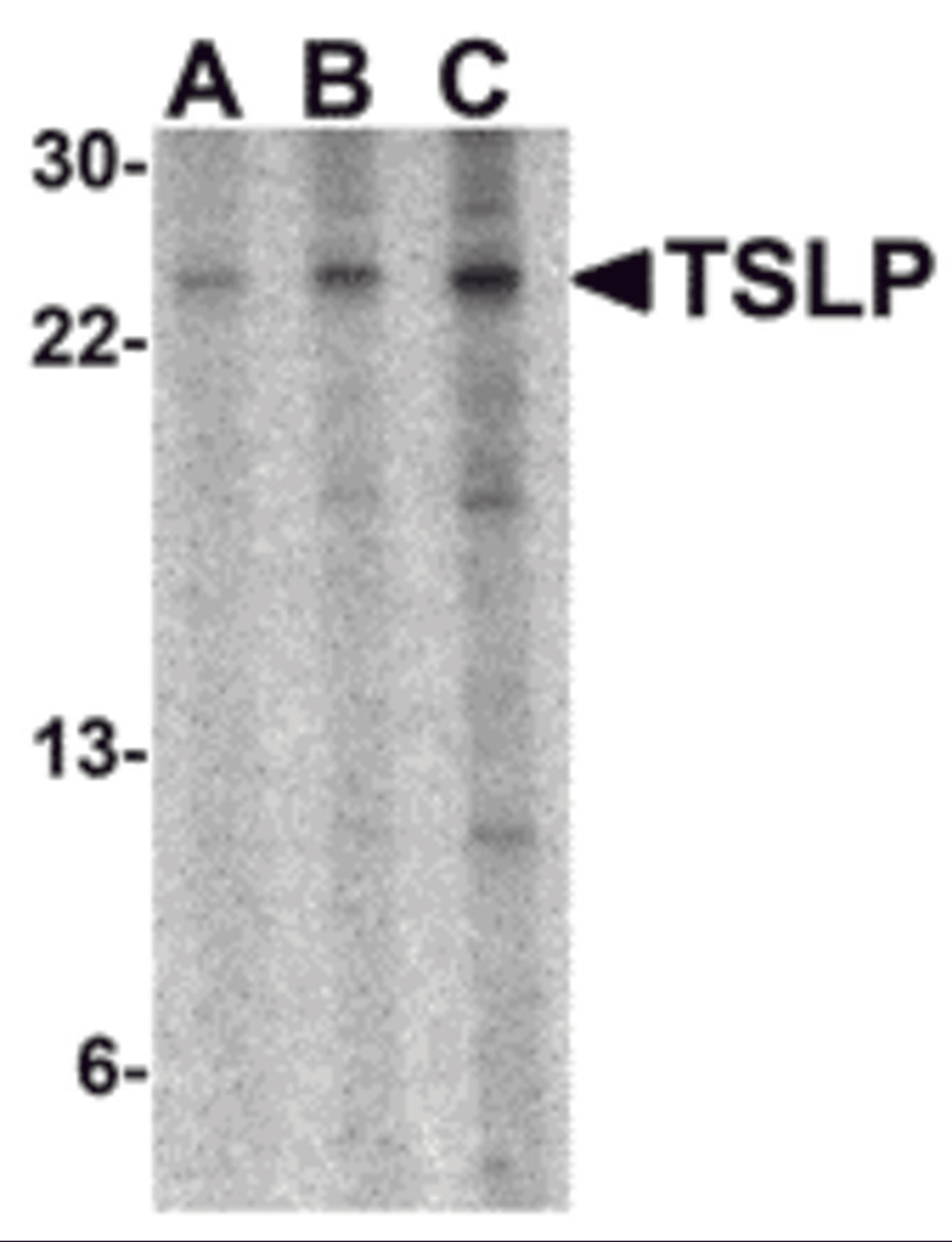 Western blot analysis of TSLP in A-20 cell lysate with TSLP antibody at (A) 0.5, (B) 1 and (C) 2 &#956;g/mL. 