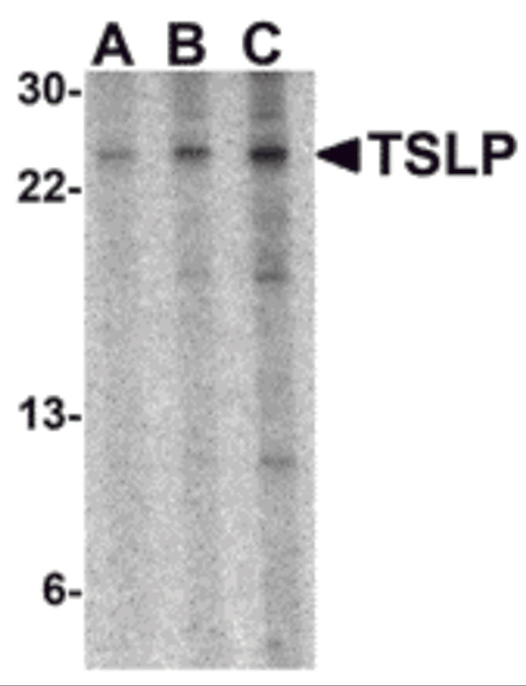 Western blot analysis of TSLP in A-20 cell lysate with TSLP antibody at (A) 0.5, (B) 1 and (C) 2 μg/mL.