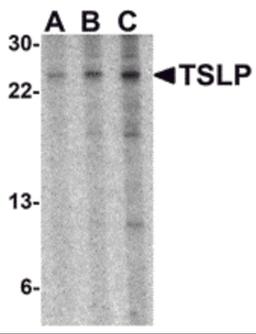 Western blot analysis of TSLP in A-20 cell lysate with TSLP antibody at (A) 0.5, (B) 1 and (C) 2 μg/mL.