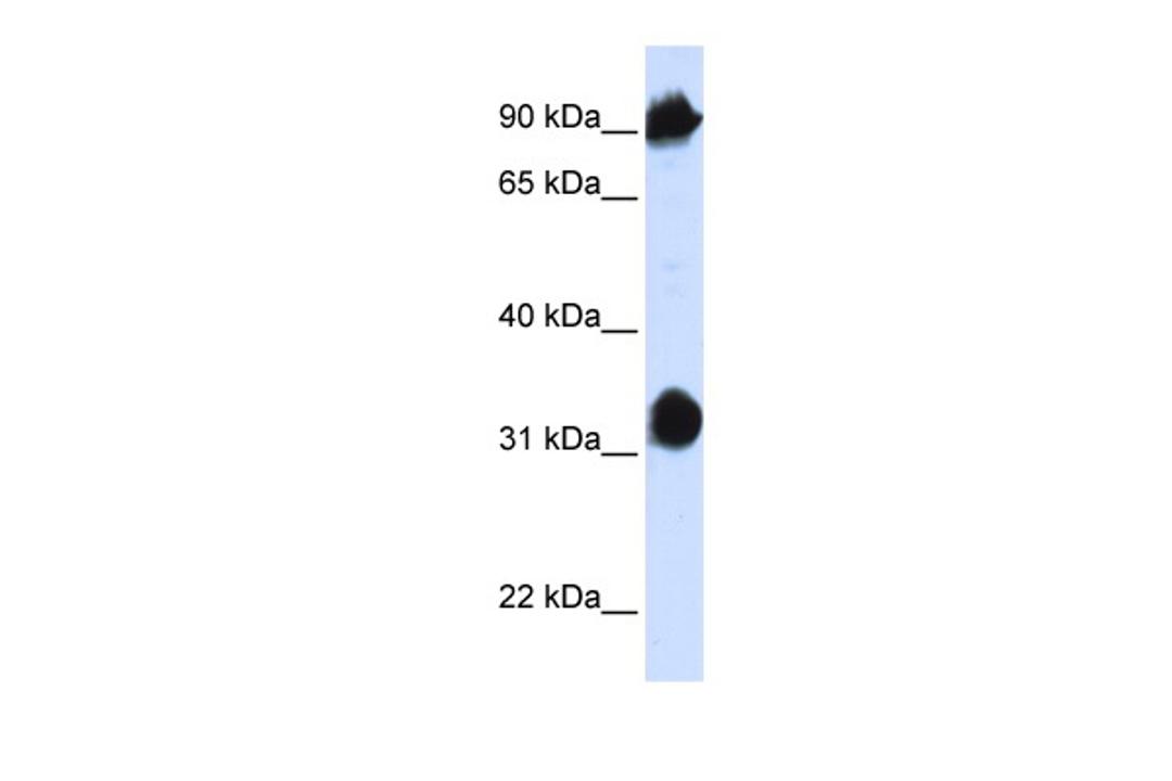 Antibody used in WB on Human 293T at 0.2-1 ug/ml.