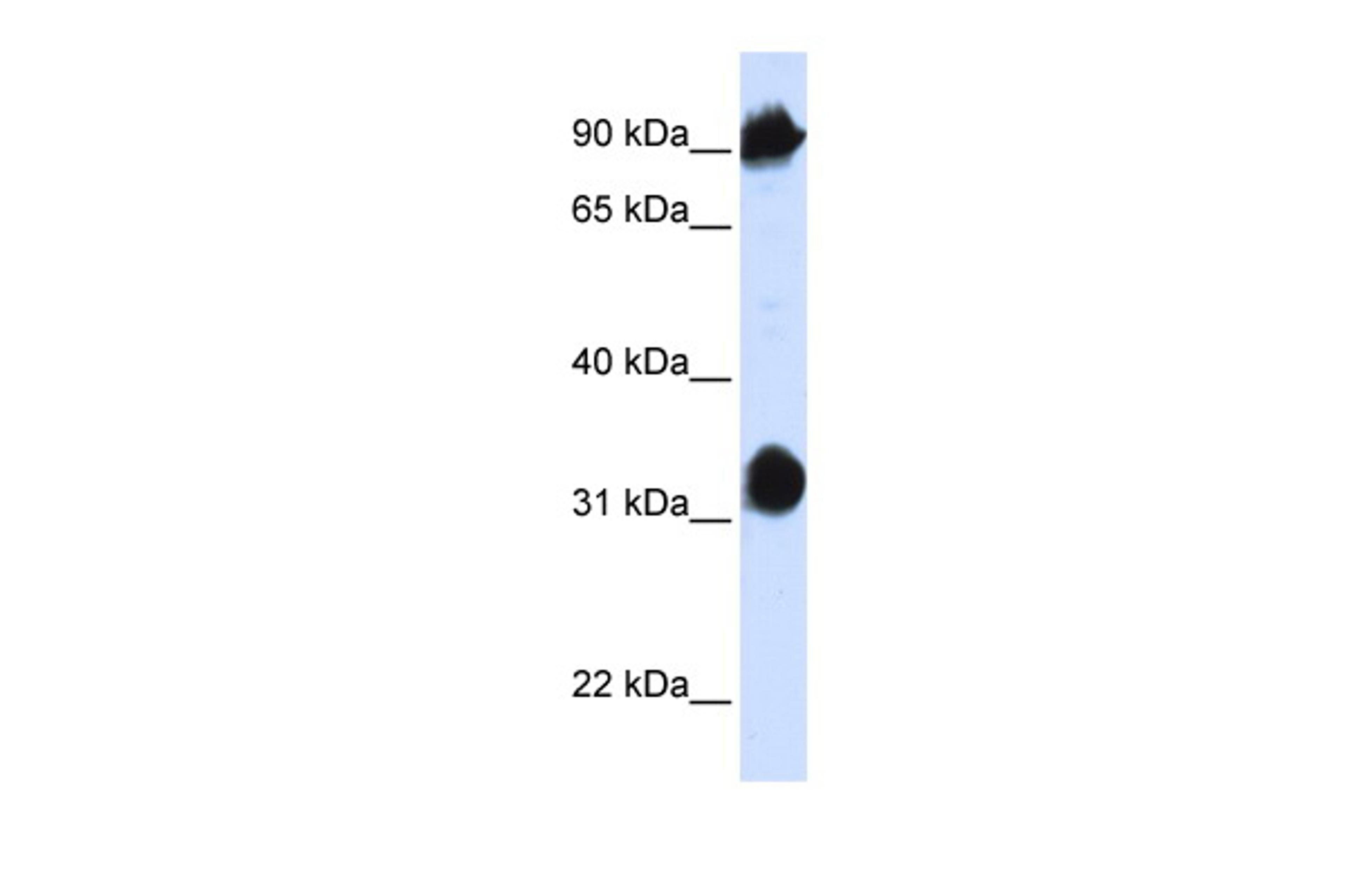 Antibody used in WB on Human 293T at 0.2-1 ug/ml.