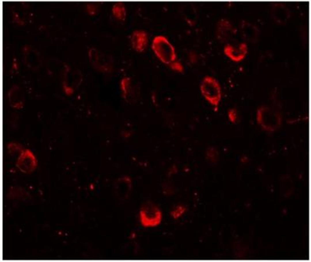 Immunocytochemistry/Immunofluorescence: CMYA5 Antibody [NBP1-77117] - SPRYD2 in mouse brain tissue with SPRYD2 antibody at 20 ug/mL.