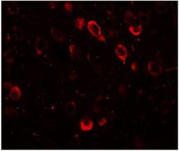 Immunocytochemistry/Immunofluorescence: CMYA5 Antibody [NBP1-77117] - SPRYD2 in mouse brain tissue with SPRYD2 antibody at 20 ug/mL.