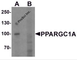 Western blot analysis of PPARGC1A in human heart tissue lysate with PPARGC1A antibody at 1 μg/ml in (A) the absence and (B) the presence of blocking peptide.