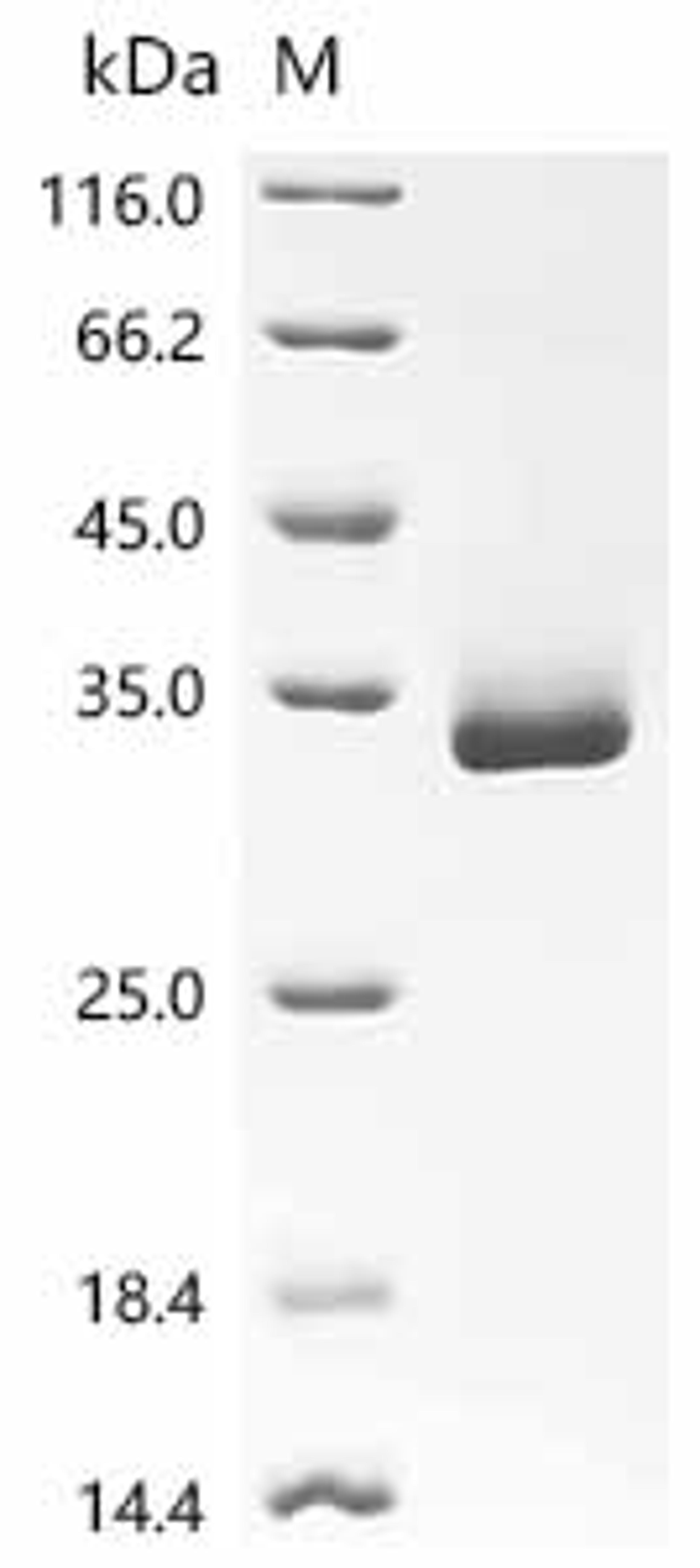(Tris-Glycine gel) Discontinuous SDS-PAGE (reduced) with 5% enrichment gel and 15% separation gel.