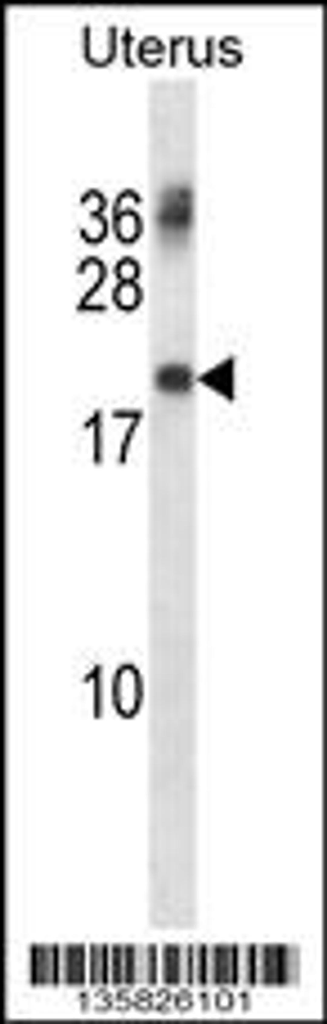 Western blot analysis in human normal Uterus tissue lysates (35ug/lane).